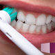 Illustration for article titled The Best Electric Toothbrushes, According to Our Readers
